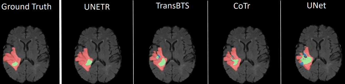 unetr-results